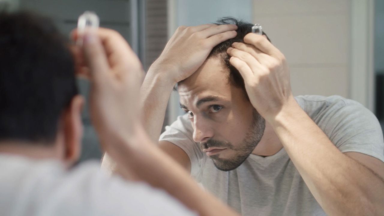 تأثیر محصولات طبیعی برای الوپسی آندروژنیک (ریزش مو) مردانه